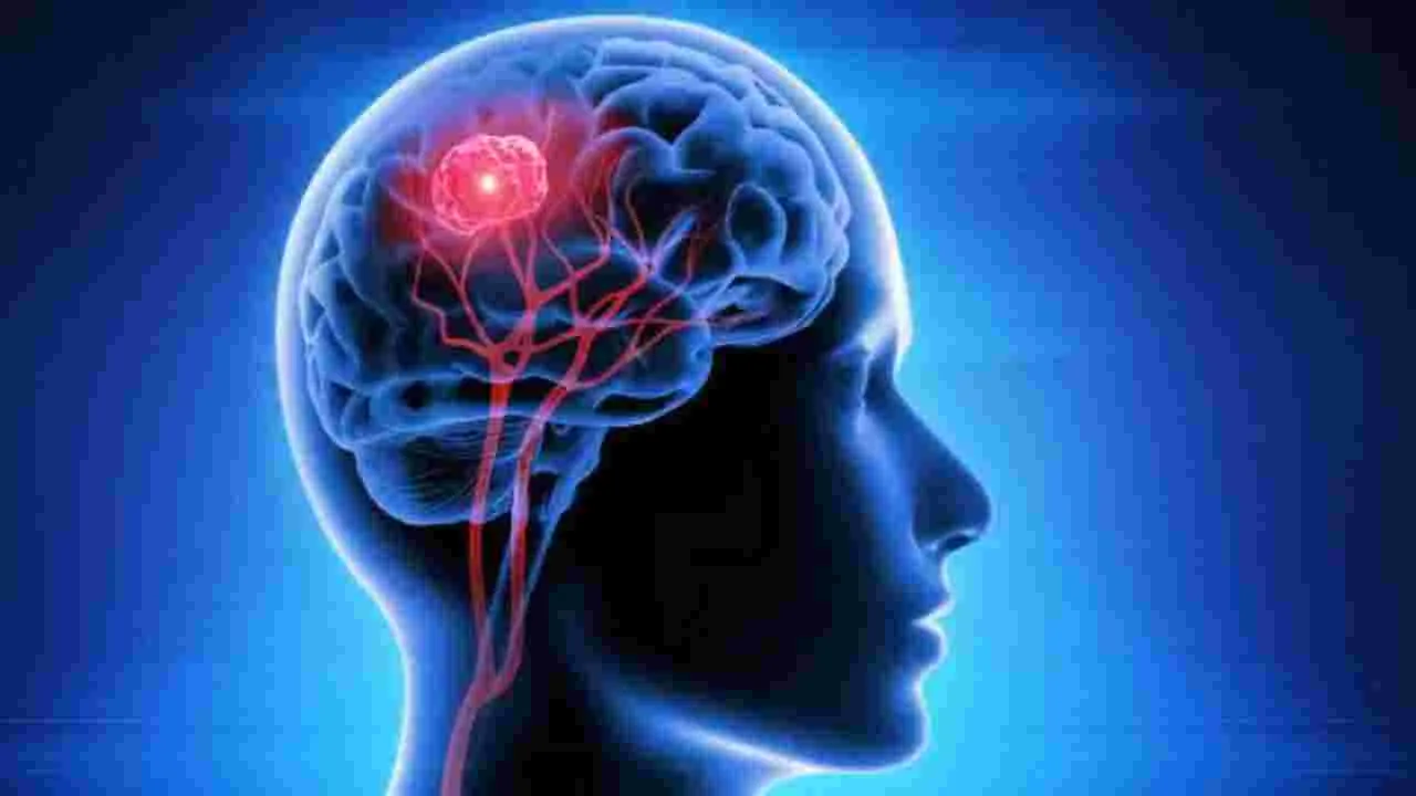 Brain Tumor: ఈ ఐదు సంకేతాలు కనిపిస్తే.. బ్రెయిన్ ట్యూమర్ ఉండే ఛాన్స్!