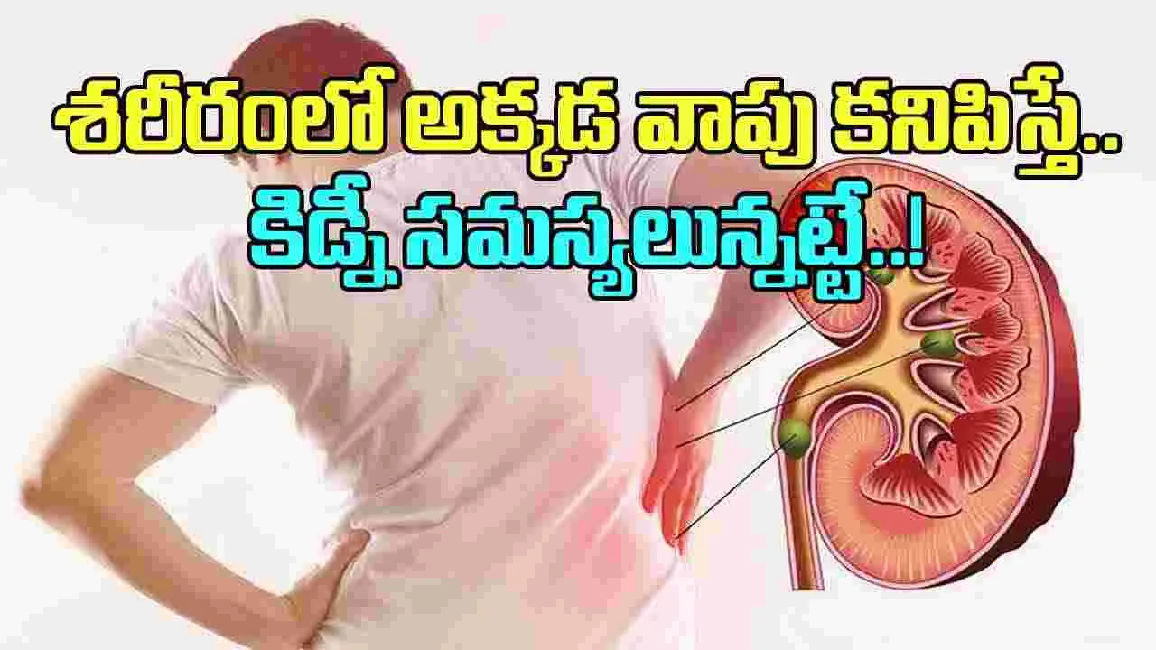 Kidney:  శరీరంలో ఈ అవయవాలలో వాపు కనిపిస్తే కిడ్నీ సమస్యలున్నట్టే.. వెంటనే డాక్టర్ దగ్గరకు వెళ్లాల్సిందే..!