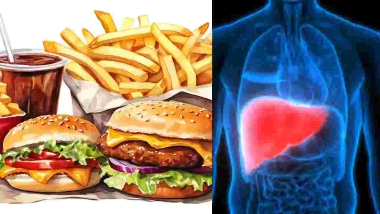 Liver Problems: మద్యం కన్నా ఎక్కువగా లివర్‌ని డ్యామేజ్ చేసే ఆహార పదార్థాలు ఇవే..