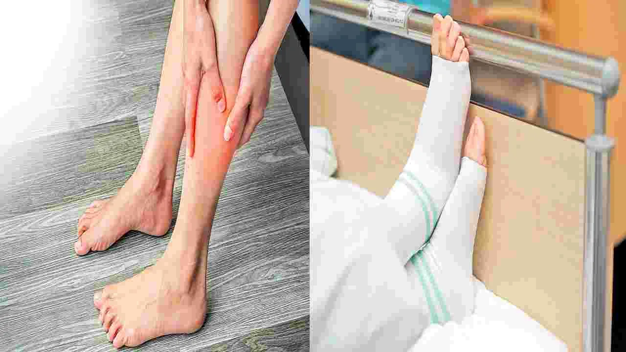 Thrombosis : ఆ వాపులు విషమం కావచ్చు