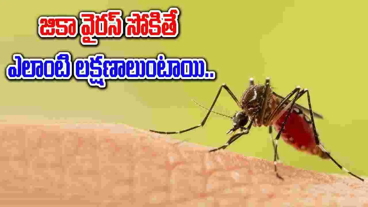 Health Tips : జికా వైరస్ అంటే ఏమిటి? దోమకాటును నివారించాలంటే ఎలాంటి చిట్కాలు పాటించాలి..!