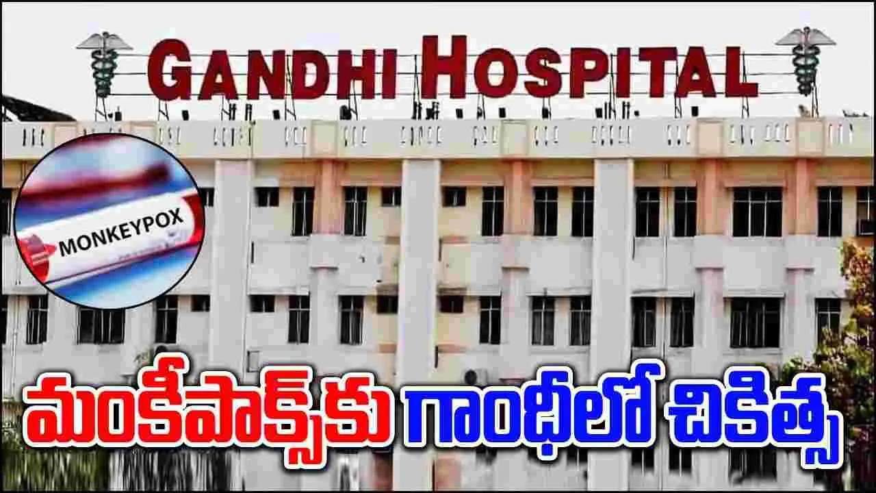 MonkeyPox: మంకీపాక్స్‌పై తెలంగాణ సర్కార్ అప్రమత్తం.. గాంధీ, ఫీవర్ ఆసుపత్రుల్లో ప్రత్యేక వార్డుల ఏర్పాటు