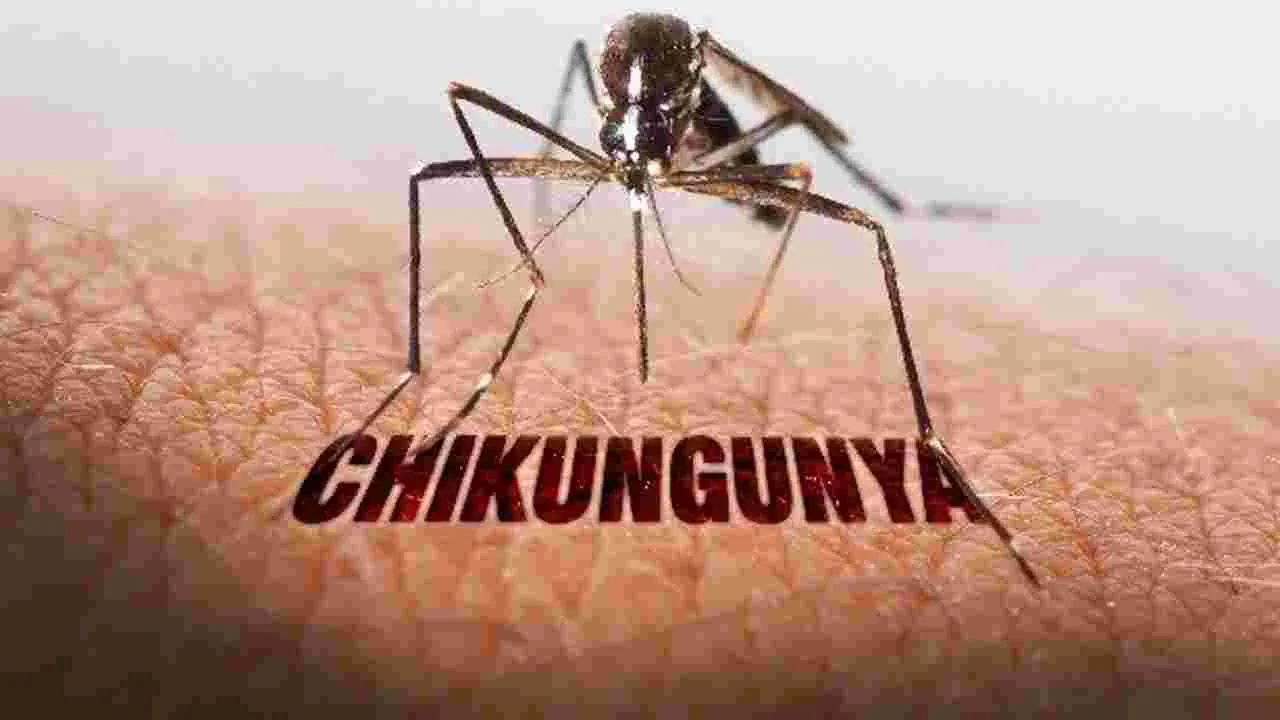 Chikun Gunya: తమిళనాడులో.. పెరుగుతున్న చికున్‌గున్యా