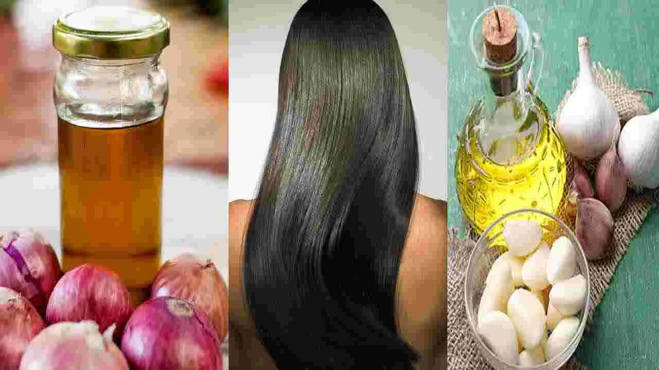 Hair Oil: ఉల్లిపాయ నూనె లేదా వెల్లుల్లి నూనె.. జుట్టు మందంగా,  ఒత్తుగా పెరగాలంటే ఏ నూనె మంచిదంటే..!