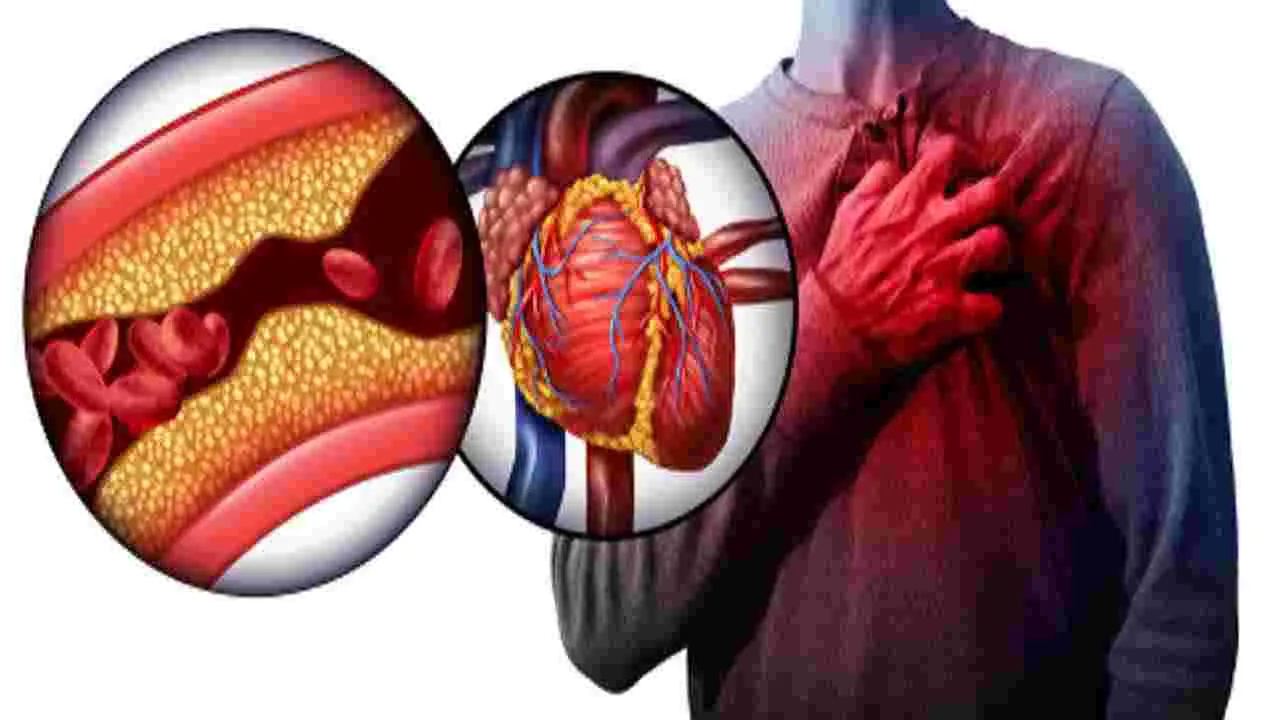 Heart Blockage: మీ ధమనులు శుభ్రంగా ఉన్నాయా లేదా ఇలా నిర్ధారించుకోండి..