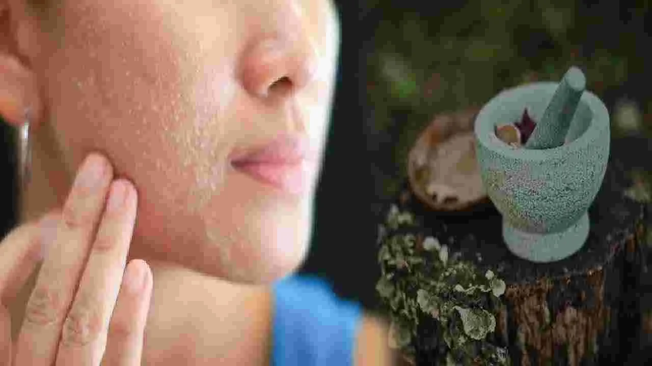 Dry Skin: మీది పొడి చర్మమా? ఆయుర్వేదం చెప్పిన ఈ టిప్స్ పాటిస్తే చలికాలంలో సేఫ్..!