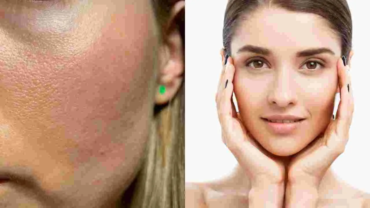 Beauty Tips: మీ ముఖం జిడ్డుగా ఉందా.. ఈ చిట్కాలు పాటిస్తే మెరిసిపోతారు..