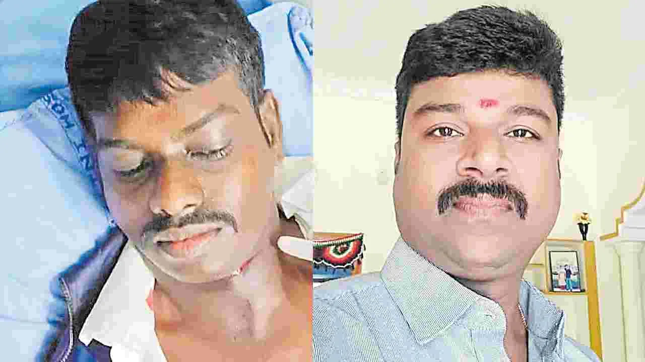 Kite Accidents: తెగిన బతుకు దారం