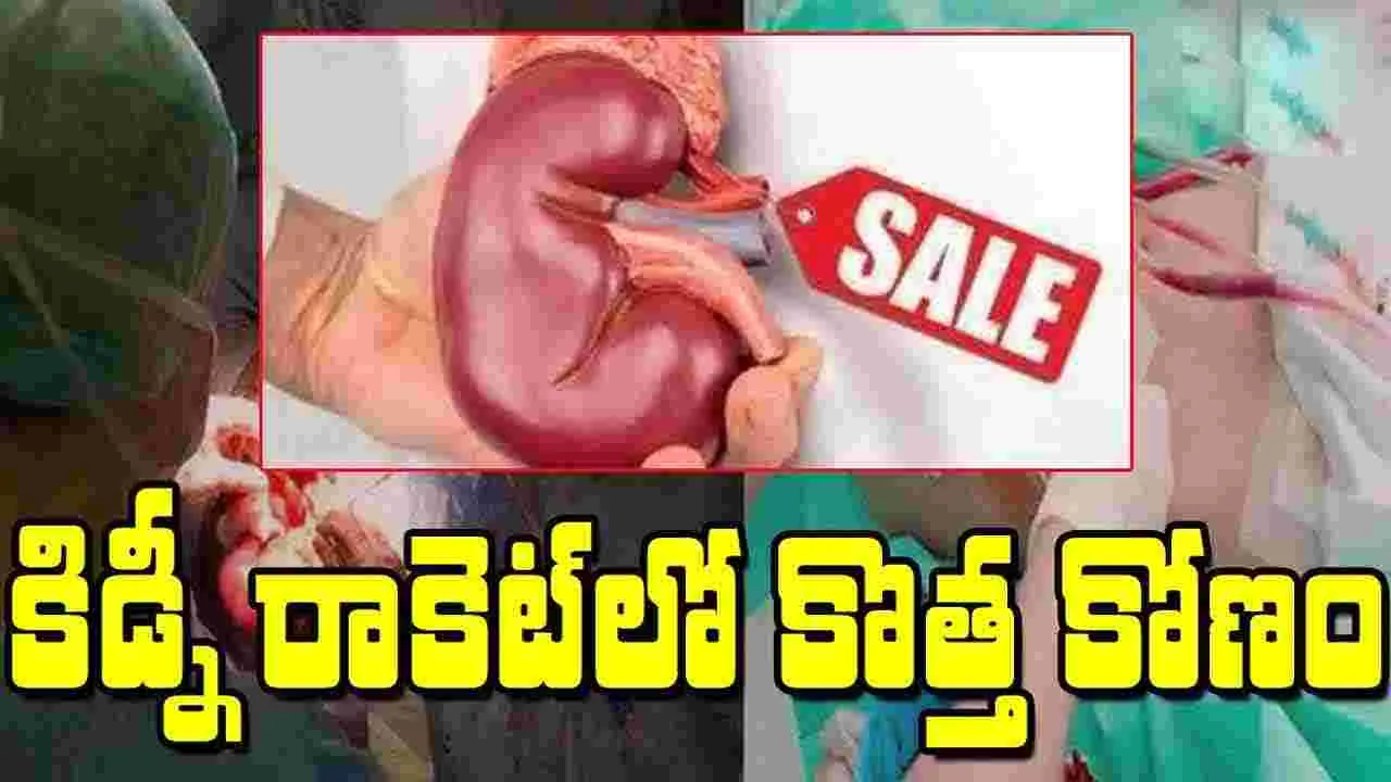 Kidney Racket: హైదరాబాద్‌లో కిడ్నీ రాకెట్ కలకలం