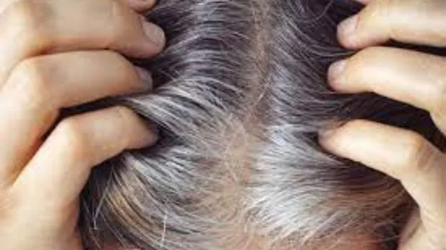 Premature White Hair Reasons: చిన్న వయసులో తెల్ల జుట్టు వస్తుందా? డైట్‌లోని ఈ పొరపాట్లే కారణం కావచ్చు!