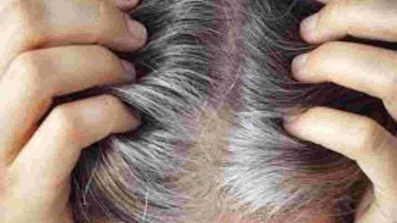 Hair Care Tips: ఈ నూనెను వాడితే చాలు.. జుట్టుకు రంగు వేయాల్సిన అవసరం లేదు.. 