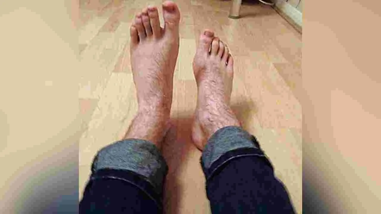 Weight Loss Paralysis: జిమ్ ట్రెయినర్‌కు షాక్.. 15 రోజుల్లో 10 కేజీల బరువు తగ్గినందుకు పక్షవాతం!