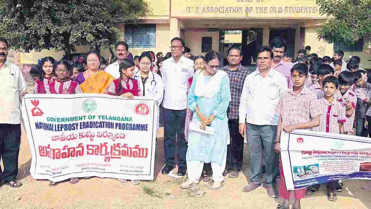 మందులు, చికిత్సతో కుష్ఠు నియంత్రణ