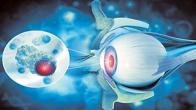 Eye Cancer: క్యాన్సర్ ‘కన్నె’ర్ర