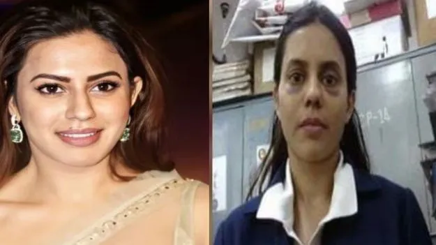 Ranya Rao Gold Smuggling: నటి రన్యా రావు ముఖంపై గాయాలు.. డీఆర్ఐ అధికారుల ఏం చెప్పారంటే.. 