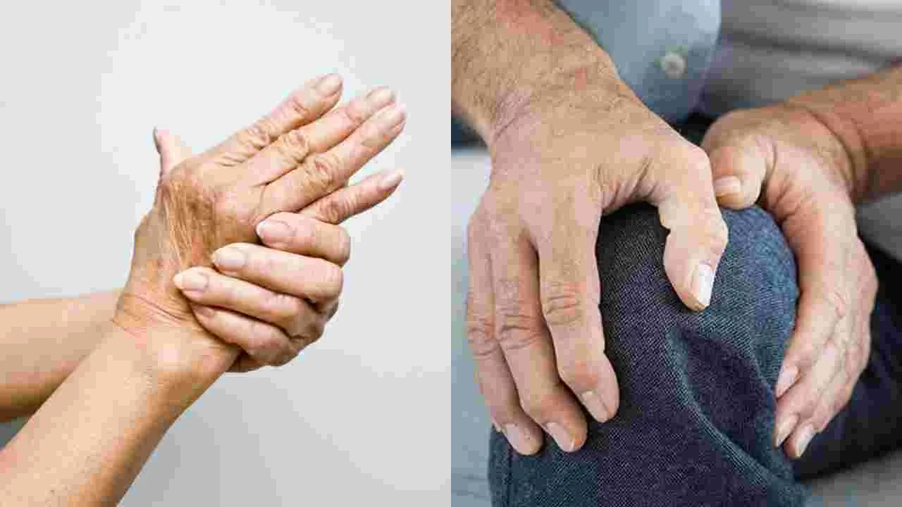 Arthritis: ఆర్థరైటిస్ తగ్గాలంటే ఈ ఆహారాలు తినండి