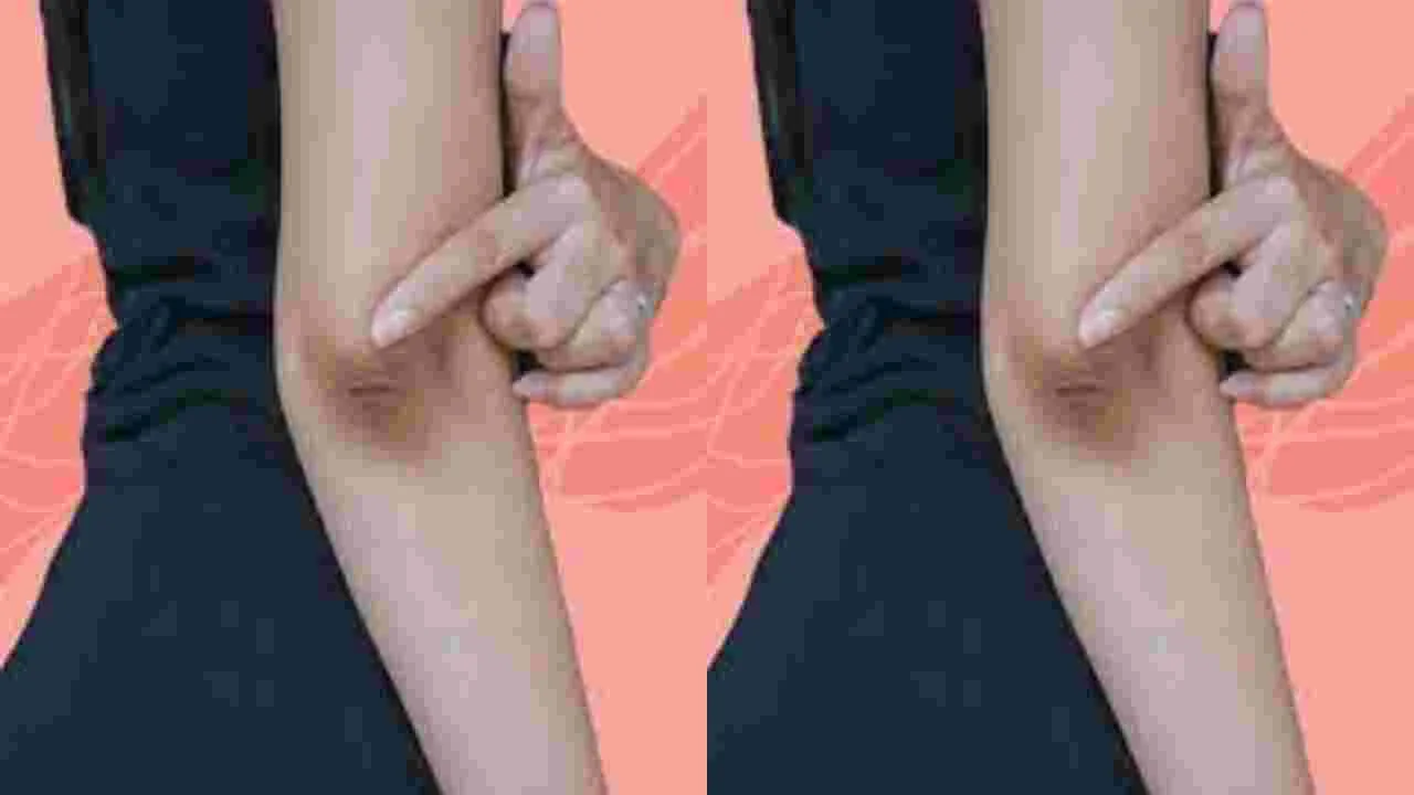 Clean Dark Elbow: ఈ వస్తువులతో మీ మోచేతుల నలుపు మాయం..