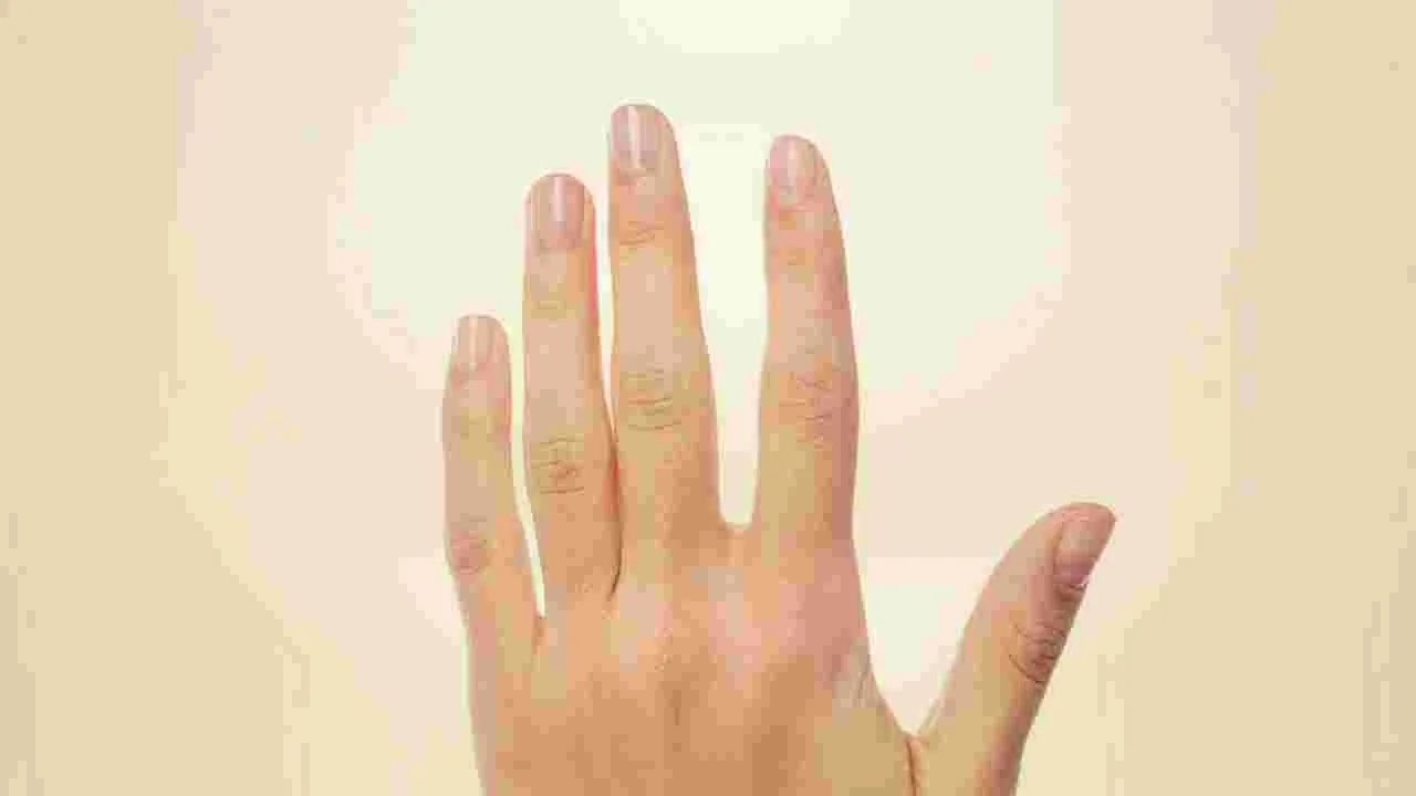 Peeling Skin on Hands: మీ వేళ్లపై చర్మం ఊడిపోవడానికి ప్రధాన కారణాలు ఇవే