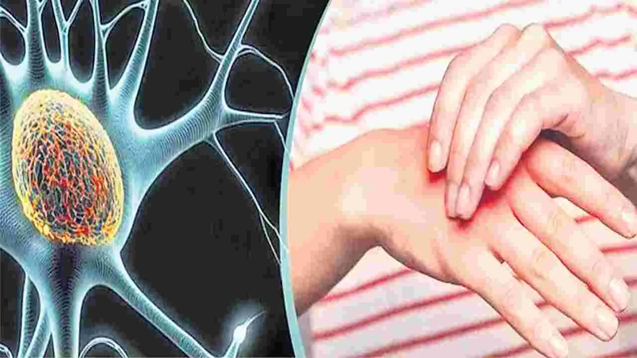జీబీఎస్ కలకలం