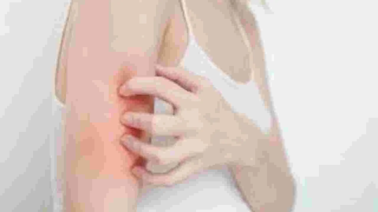 Remedies for Itchy Skin: ఈ సులభమైన చిట్కాలతో చెమట వల్ల కలిగే దురద మాయం..