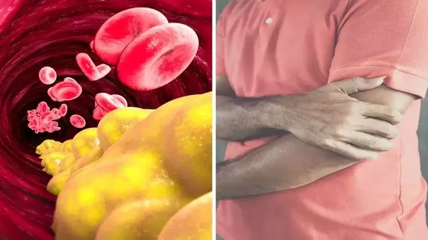 Cholesterol Symptoms : శరీరంలో కొలెస్ట్రాల్ పెరిగినప్పుడు చర్మంపై కనిపించే 5 సంకేతాలు..