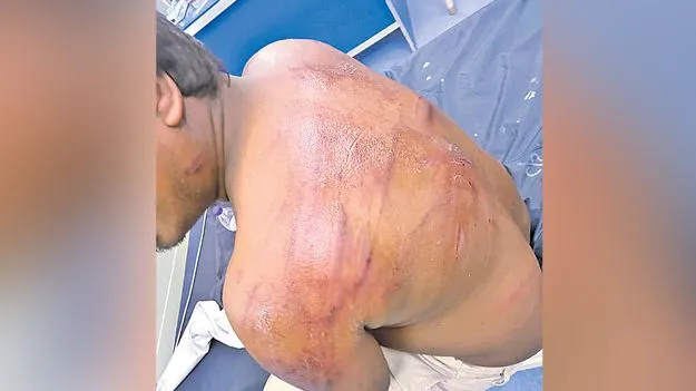 Hyderabad: దుస్తులు విప్పించి.. రోడ్డుపై నగ్నంగా నిలబెట్టి..