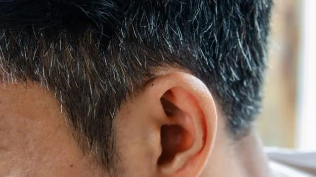 Premature Greying: జుట్టు నెరవడాన్ని అడ్డుకోవాలంటే ఈ ఫుడ్స్ తినడం తప్పనిసరి