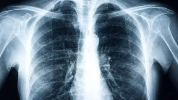 Doctor Fears Job Loss: నా జాబ్ పోవడం పక్కా.. ఇక రెస్టారెంట్‌లో పని చేసుకోవడమే.. డాక్టర్ పోస్టు వైరల్