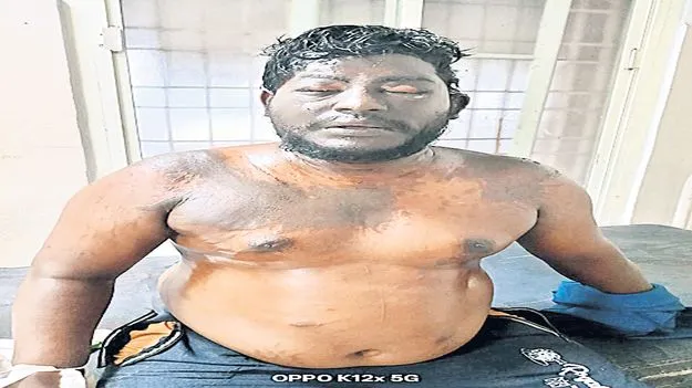 మద్యం సేవించి వేధిస్తున్న భర్తపై వేడి నూనెతో దాడి