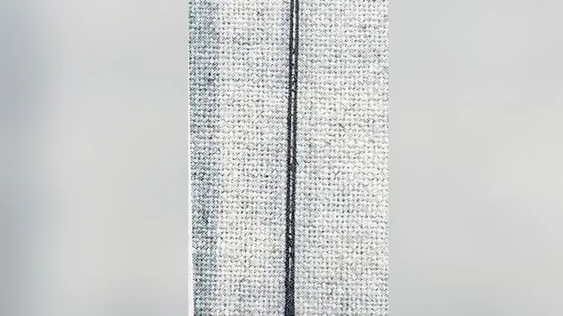 డ్రైవర్‌ కడుపులో 2 ఇంచుల సూది