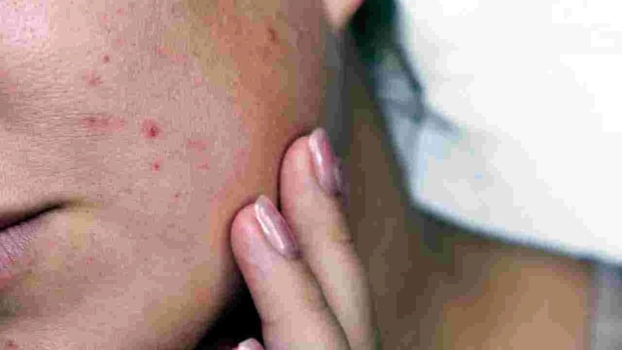 Face Health: ముఖంపై ఈ 6 సంకేతాలు కనిపిస్తున్నాయా.. అయితే ముందుగానే జాగ్రత్తపడండి..