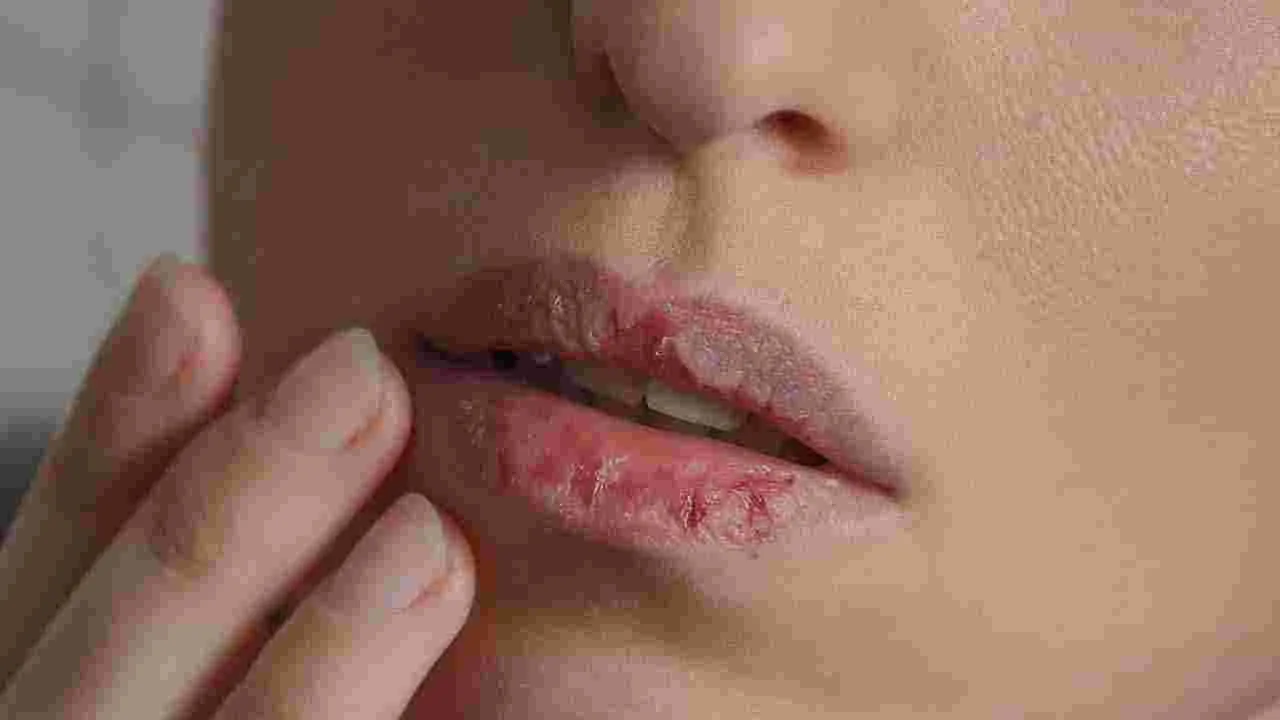 Face Health: ముఖంపై ఈ 6 సంకేతాలు కనిపిస్తున్నాయా.. అయితే ముందుగానే జాగ్రత్తపడండి..