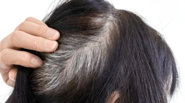 Hair Tips: రంగు వేసిన తర్వాత కూడా తెల్ల వెంట్రుకలు కనిపిస్తున్నాయా.. ఈ తప్పులు చేయకండి..