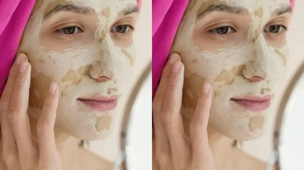 Multani Matti Face Pack Tips: వేసవిలో కాంతివంతమైన ముఖం కోసం ముల్తానీ మిట్టితో ఈ టిప్స్ ట్రై చేయండి..