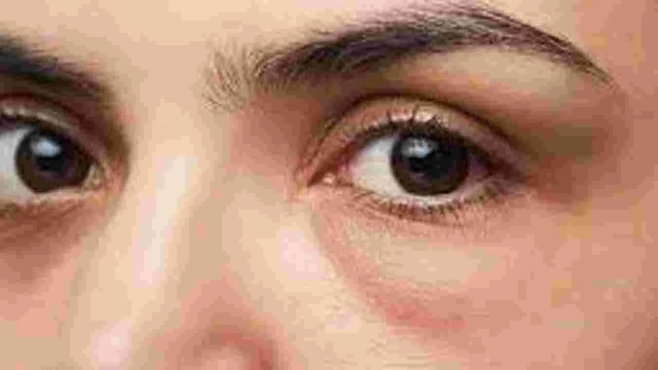 Face Health: ముఖంపై ఈ 6 సంకేతాలు కనిపిస్తున్నాయా.. అయితే ముందుగానే జాగ్రత్తపడండి..