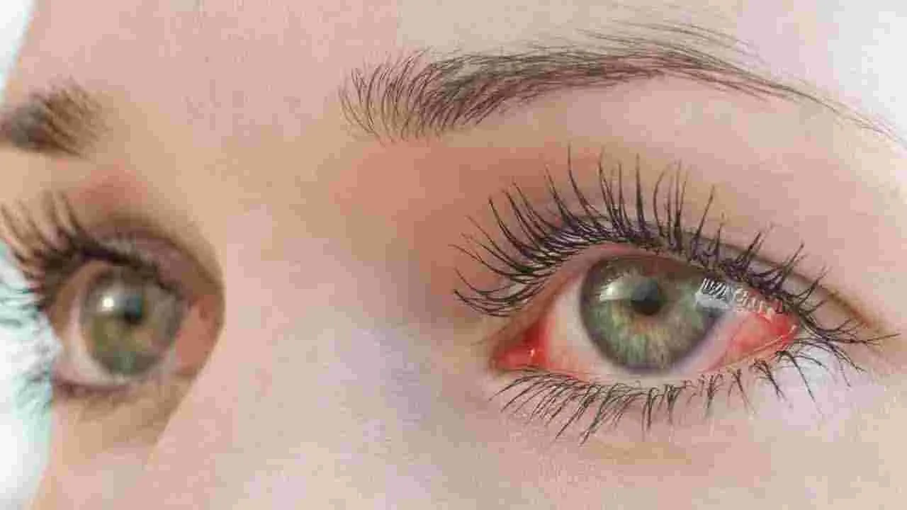 Face Health: ముఖంపై ఈ 6 సంకేతాలు కనిపిస్తున్నాయా.. అయితే ముందుగానే జాగ్రత్తపడండి..