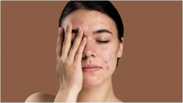 Sensitive Skin Care Tips: మీ చర్మం సున్నితంగా ఉందా.. వేసవిలో ఈ ముఖ్య విషయాలను గుర్తుంచుకోండి..