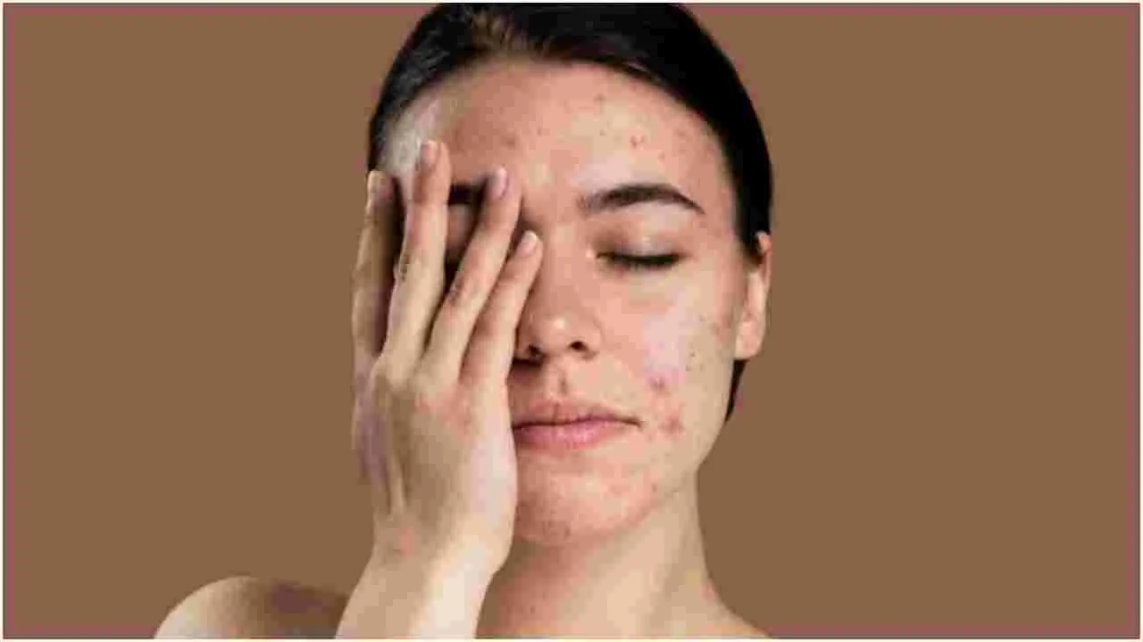 Sensitive Skin Care Tips: మీ చర్మం సున్నితంగా ఉందా.. వేసవిలో ఈ ముఖ్య విషయాలను గుర్తుంచుకోండి..