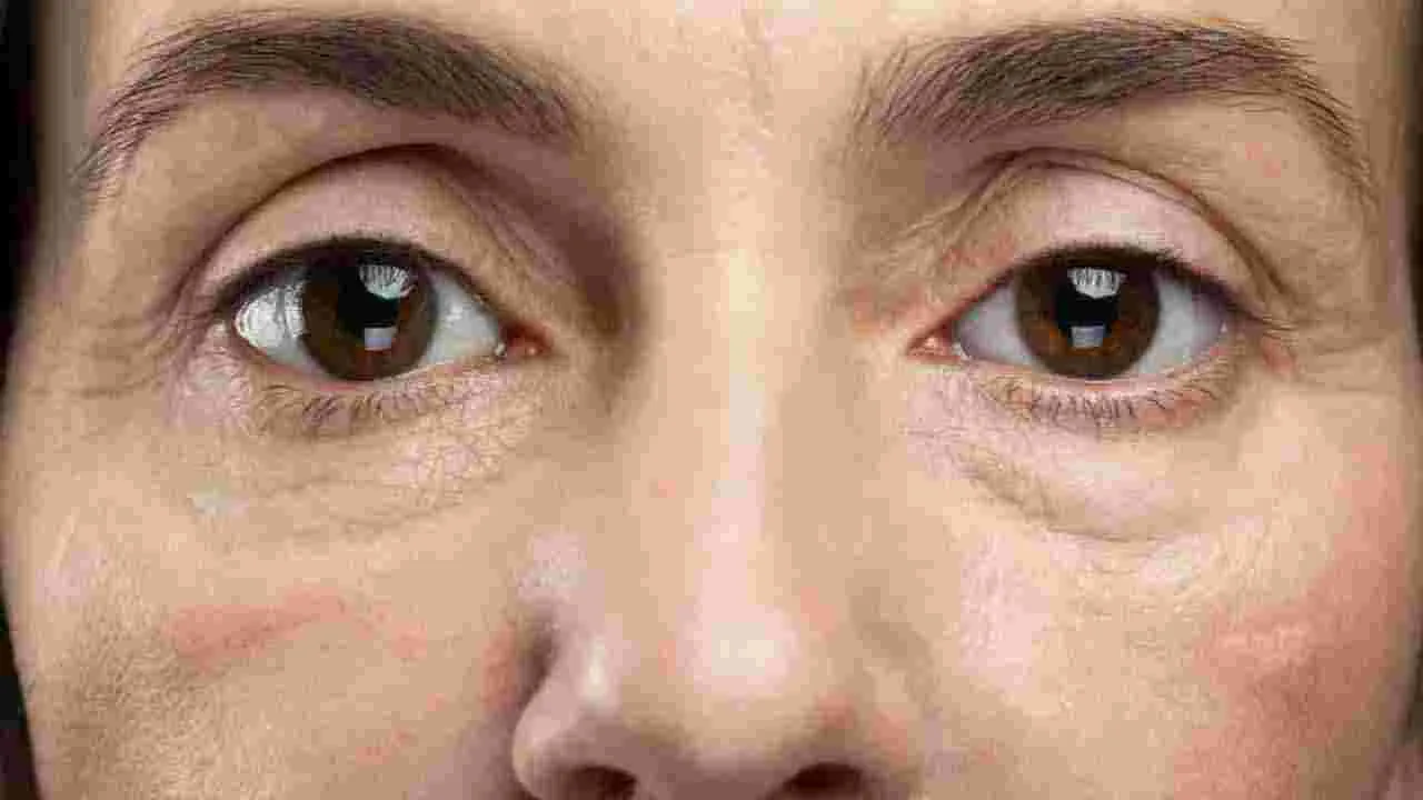 Face Health: ముఖంపై ఈ 6 సంకేతాలు కనిపిస్తున్నాయా.. అయితే ముందుగానే జాగ్రత్తపడండి..