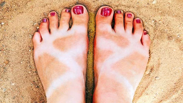 Foot Tan Removal Tips: చెప్పుల మచ్చలా