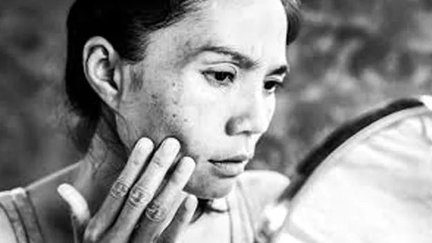 Facial Black Spots: ఆ మచ్చలు ప్రమాదకరమా