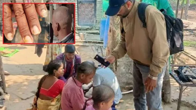 Maharashtra: అప్పుడు అందరికీ బట్టతల వైరస్.. ఇప్పుడు ఇంకోటి.. వరస మిస్టరీ వైరస్‌లకు కారణమేంటి..