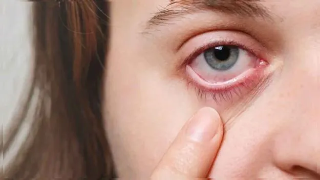 Eye Cancer: సైలెంట్గా కళ్లను కాటేస్తున్న క్యాన్సర్.. ఈ లక్షణాలుంటే బీ అలర్ట్..