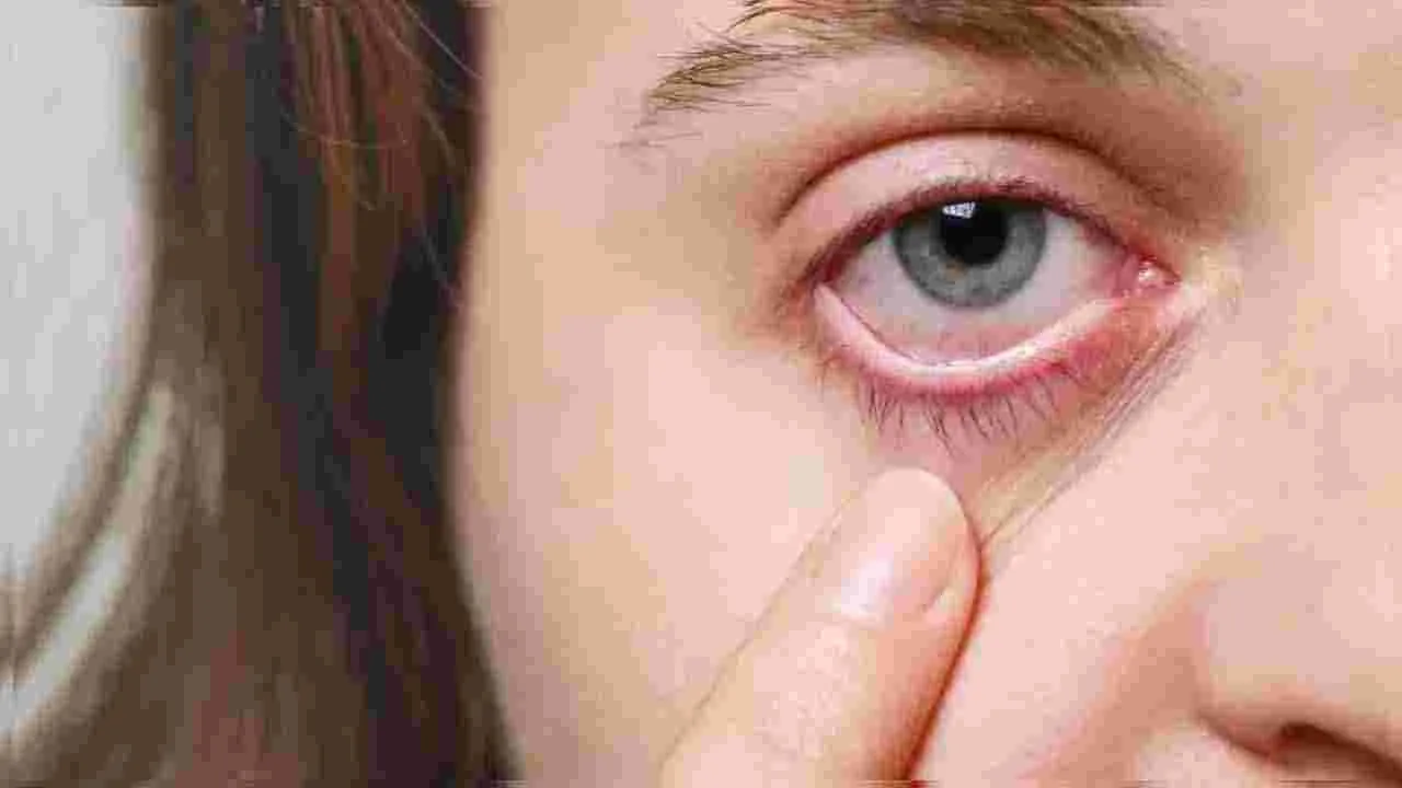 Eye Cancer: సైలెంట్‌గా కళ్లను కాటేస్తున్న క్యాన్సర్.. ఈ లక్షణాలుంటే బీ అలర్ట్..
