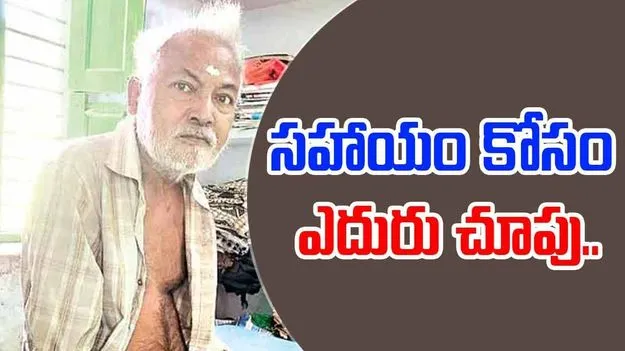 GV Babu: అనారోగ్యంతో బలగం నటుడు.. సహాయం కోసం ఎదురు చూపు..
