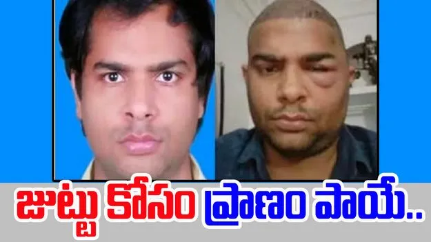 Hair Transplant Horror: హెయిర్ ట్రాన్స్ప్లాంటేషన్ దారుణం.. మరో ఇంజనీర్ బలి..