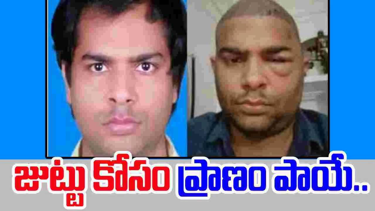 Hair Transplant Horror: హెయిర్ ట్రాన్స్‌ప్లాంటేషన్ దారుణం.. మరో ఇంజనీర్ బలి..
