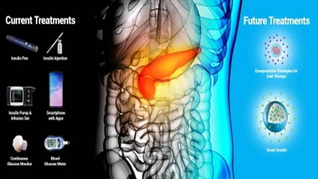 Aparanji Poosarla: టైప్‌ 2 డయాబెటిస్‌ నిర్ధారణకు సెన్సార్‌