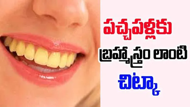 Remedies For Yellow Teeth: మీ దంతాలు పచ్చగా ఉన్నాయా.. ఇలా చేస్తే మెరిసిపోవాల్సిందే