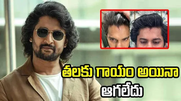 Nani Head Injury: నాని తలకు గాయం.. అయినా షూటింగ్ ఆపలేదు..
